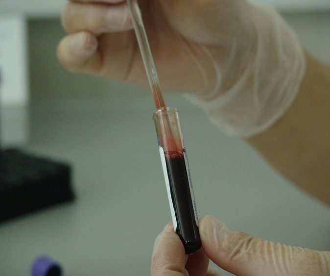Do you really need to fast before a blood test?