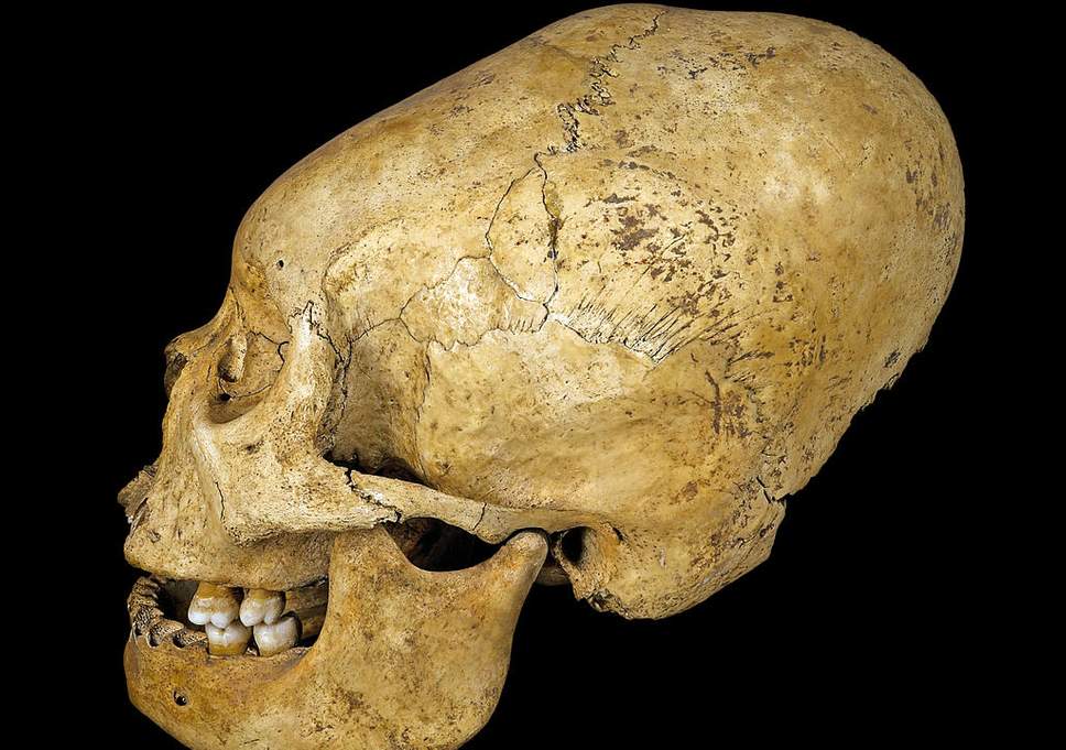 Ancient Peruvians gave themselves elongated skulls as a mark of status